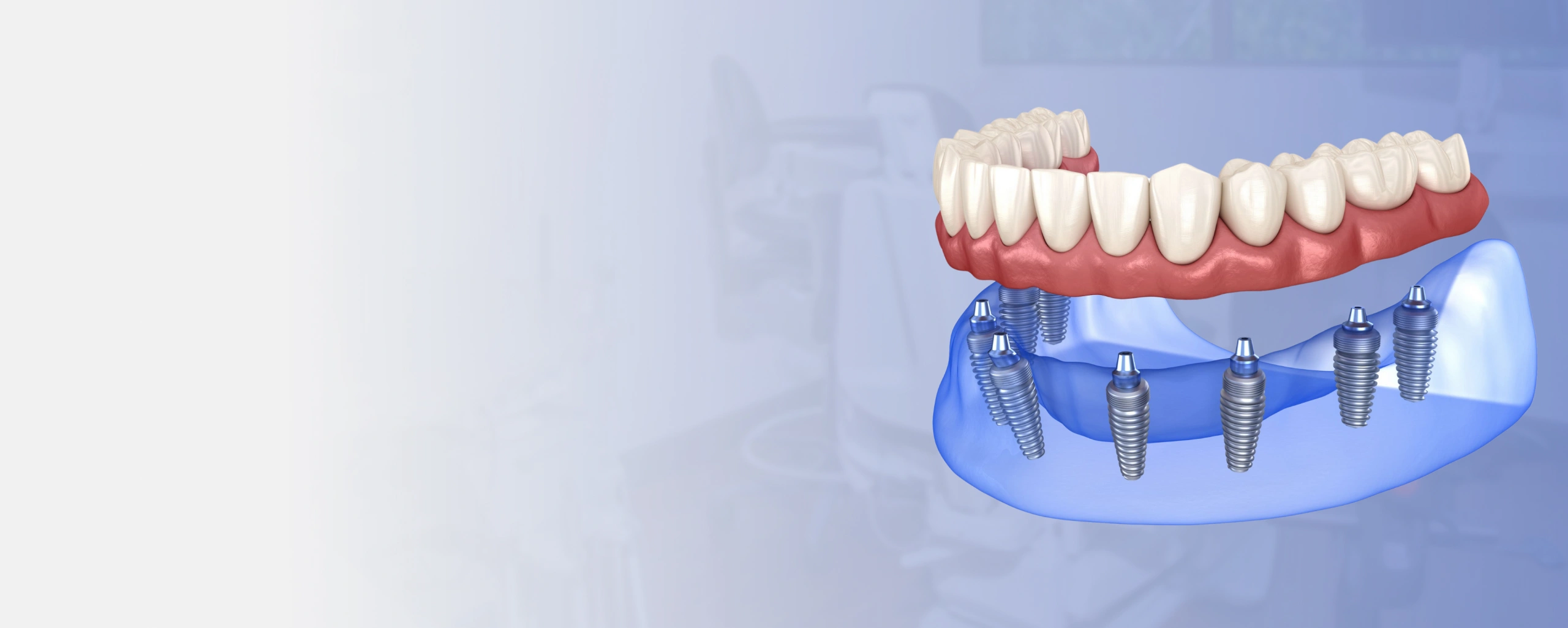 img-Permanent-Solutions-for-Missing-Teeth-bg
